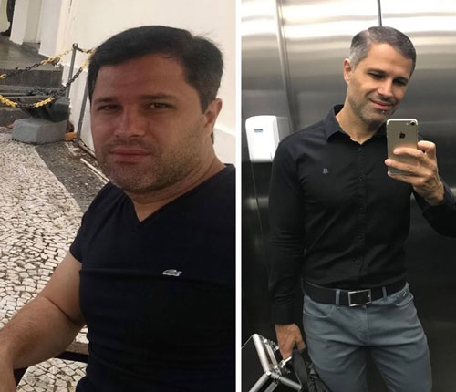 antes-depois-01a