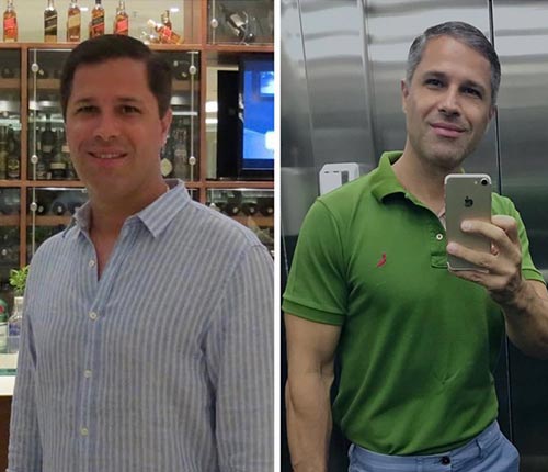 antes-depois-03-A